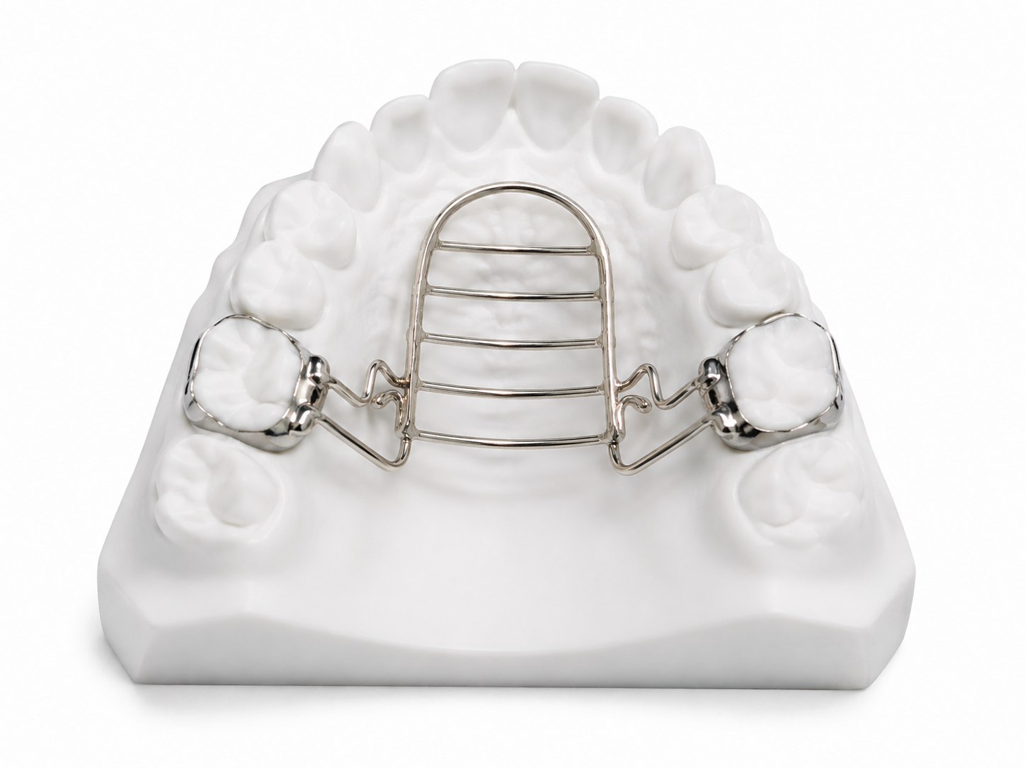 Dental model showing a myofunctional wire tongue crib appliance on upper arch